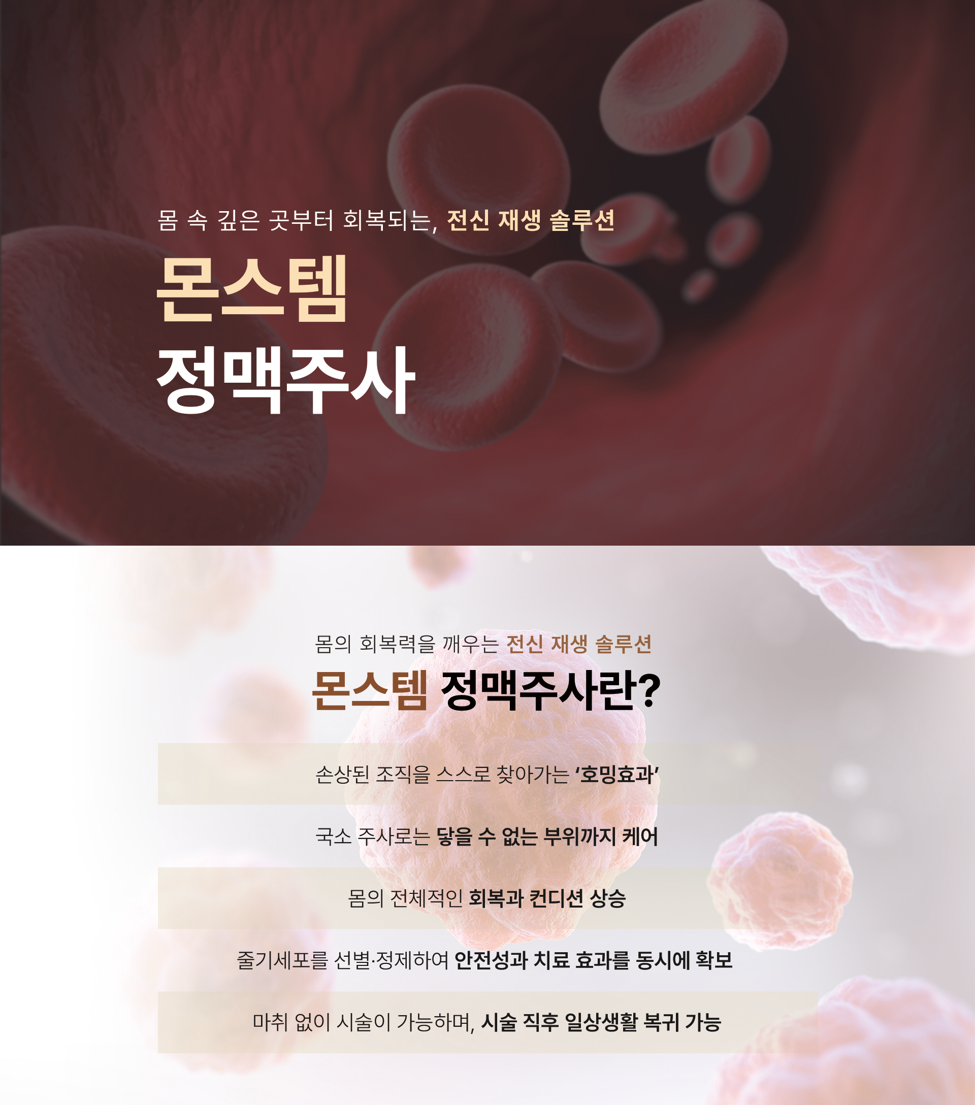 몬스템 정맥주사