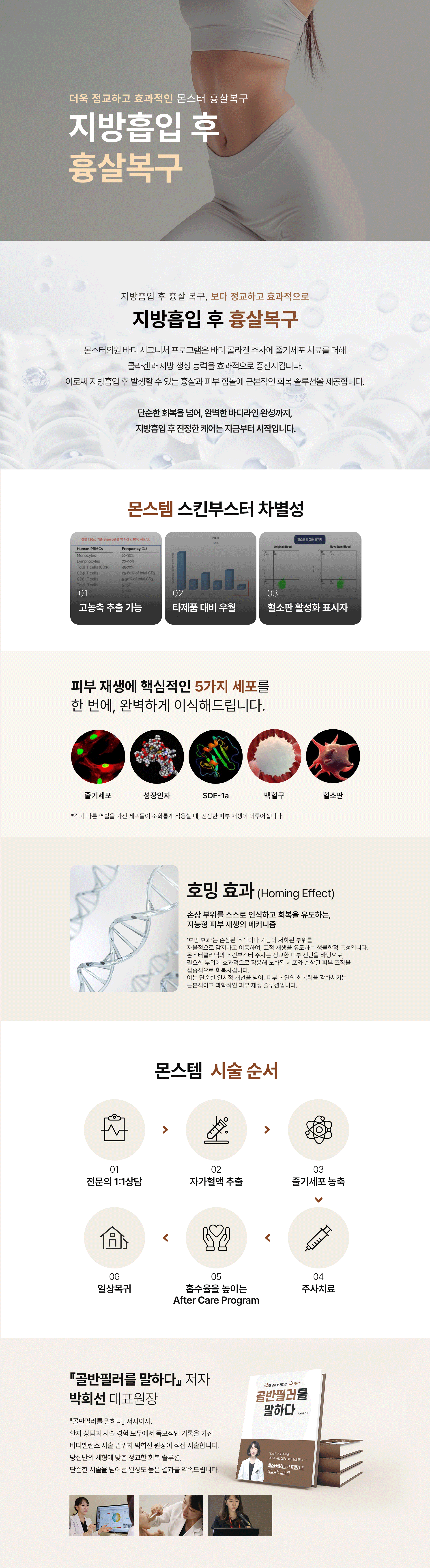 몬스템 흉살복구