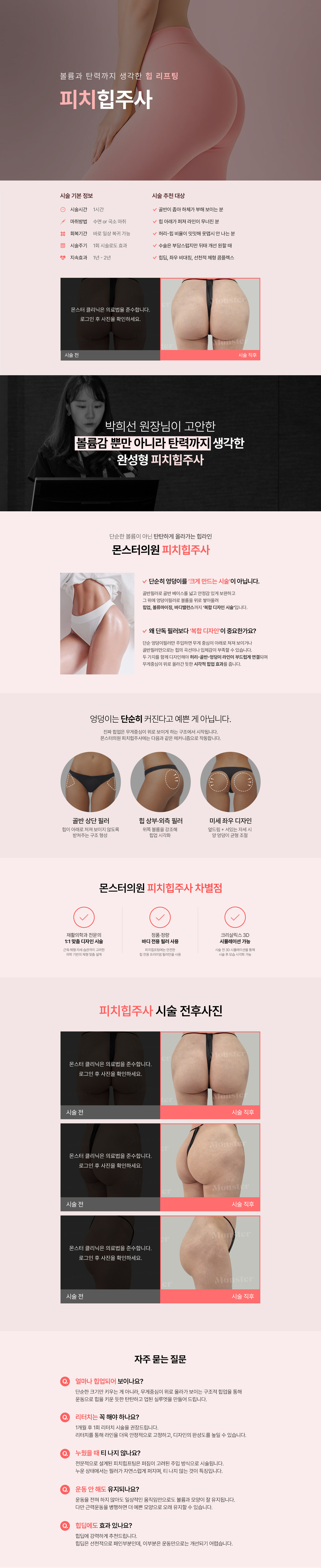 몬스터클리닉